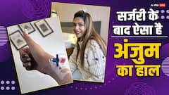 'कुंडली भाग्य' फेम अंजुम फकीह की सर्जरी के बाद कैसी है हालत?