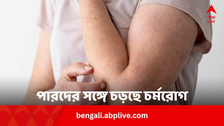 Skin Diseases In Summer: পারদ চড়ার সঙ্গে সঙ্গে ত্বকের নানা সমস্যা বাড়তে থাকে। কোন কোন চর্মরোগের ভয় রয়েছে এই সময় ?