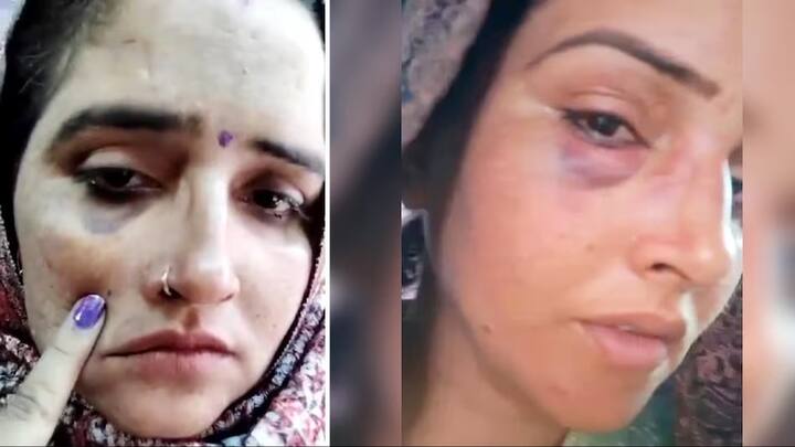 seema haider video viral injury assault went viral on social media greater noida uttar pradesh marathi news Seema Haider : पाकिस्तानी सीमा हैदरला पती सचिनकडून मारहाण? चेहरा आणि हातावर जखमेच्या खुणा; VIDEO व्हायरल