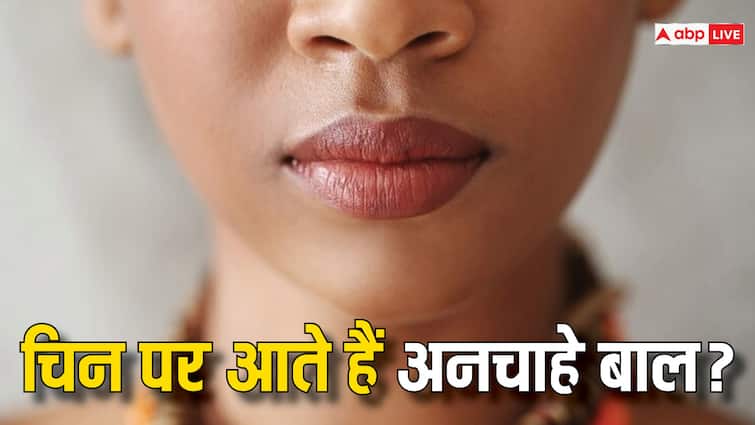 women are facing unwanted hair on their chin then follow these home remedies Beauty Tips: मह‍िलाओं की ठुड्डी पर हो रहे अनचाहे बाल, तो इन घरेलू उपायों को फॉलो कर पाएं राहत