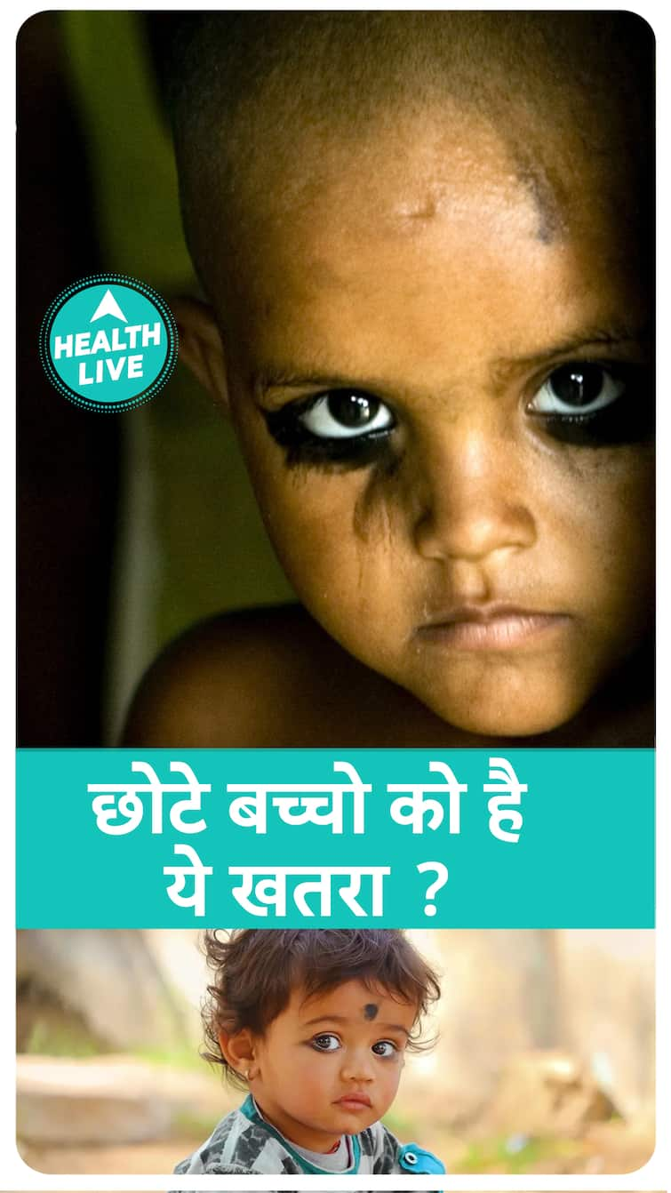 बच्चो के लिए है काजल बेहद खतरनाक ? | क्यों नहीं लगाना चाहिए काजल ? | health live