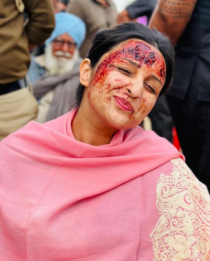 A picture shows Parineeti with blood stains on her face.