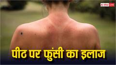 पीठ पर क्यों हो जाते हैं बारीक दाने? इन घरेलू उपाय को कर पाएं राहत