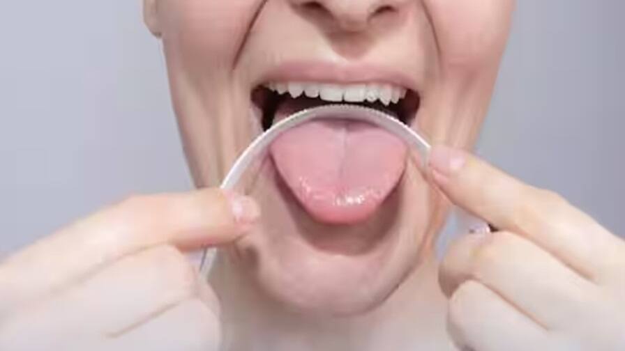 Oral Hygiene: 5 tips effective home remedies to clean tongue Oral Hygiene: દાંતની સાથે જીભની પણ કરો સફાઇ, નહી તો થશે અનેક બીમારીઓ, જાણો પાંચ ટિપ્સ