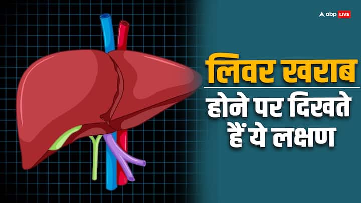 world liver day 2024 liver damage and symptoms show in fingernails read full article in hindi World Liver Day 2024: नाखून की हालत बता देगी लिवर का हाल, डैमेज होते ही कलर और साइज में होते हैं ये बदलाव