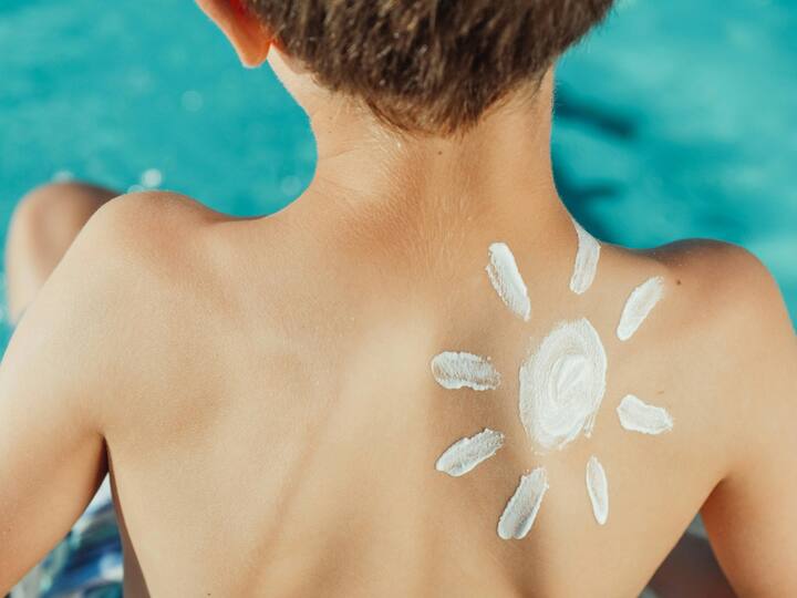 Some people may be allergic to sunscreen.  Therefore, consult a doctor before applying it (Photo credit: Pexel.com)