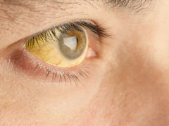 World Liver Day 2024: Know Signs Of Liver Problems In Children