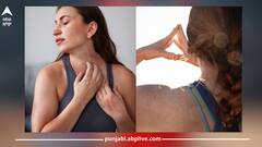 Summer Health Tips: ਗਰਮੀਆਂ 'ਚ ਪਿੱਤ ਤੋਂ ਬਚਣ ਲਈ ਅਪਣਾਓ ਇਹ ਨੁਸਖੇ, ਮਿਲੇਗੀ ਰਾਹਤ