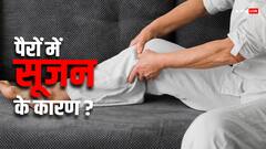 पैरों में सूजन आने पर कौन सी बीमारी का रहता है डर? जानें क्या कहते हैं डॉक्टर