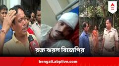 কোচবিহারে বিজেপি কর্মীকে হাঁসুয়ার কোপ, পুড়ল বিজেপি কার্যালয়,মাথা ফাটল বিজেপির বুথ সভাপতির