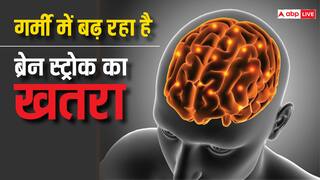 गर्मी में बरते कुछ खास सावधानी, नहीं तो हो जाएंगे ब्रेन स्ट्रोक का शिकार...ऐसे करें बचाव