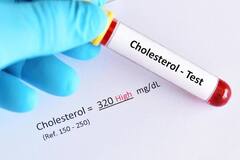 High Cholesterol : हाई कोलेस्ट्रॉल में अंडा खाएं या नहीं? अगर मन में हैं सवाल तो यहां दूर करें कंफ्यूजन