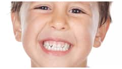 जानिए, बच्चों के दांतों में कीड़ा लगने के क्या कारण होते हैं?