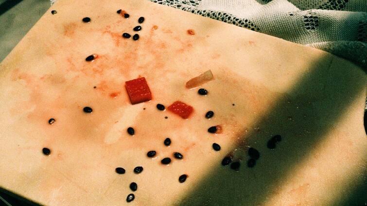 Watermelon Seeds : தர்பூசணி விதையில் இவ்ளோ நன்மைகள் இருக்கிறதா ?