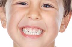 Health tips: ਬੱਚਿਆਂ ਦੇ ਦੰਦਾਂ 'ਚ ਕਿਉਂ ਲੱਗ ਜਾਂਦਾ ਕੀੜਾ? ਜਾਣੋ ਕਾਰਨ