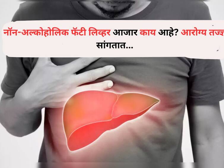 Health Lifestyle marathi news Millions of people suffer from Non-Alcoholic Fatty Liver Disease Health experts say Health : अल्कोहोलचे सेवन न करताही या आजाराने लाखो लोकांना ग्रासले, नॉन-अल्कोहोलिक फॅटी लिव्हर आजार काय आहे? आरोग्य तज्ज्ञ सांगतात...