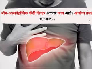 Health : अल्कोहोलचे सेवन न करताही या आजाराने लाखो लोकांना ग्रासले, नॉन-अल्कोहोलिक फॅटी लिव्हर आजार काय आहे? आरोग्य तज्ज्ञ सांगतात...