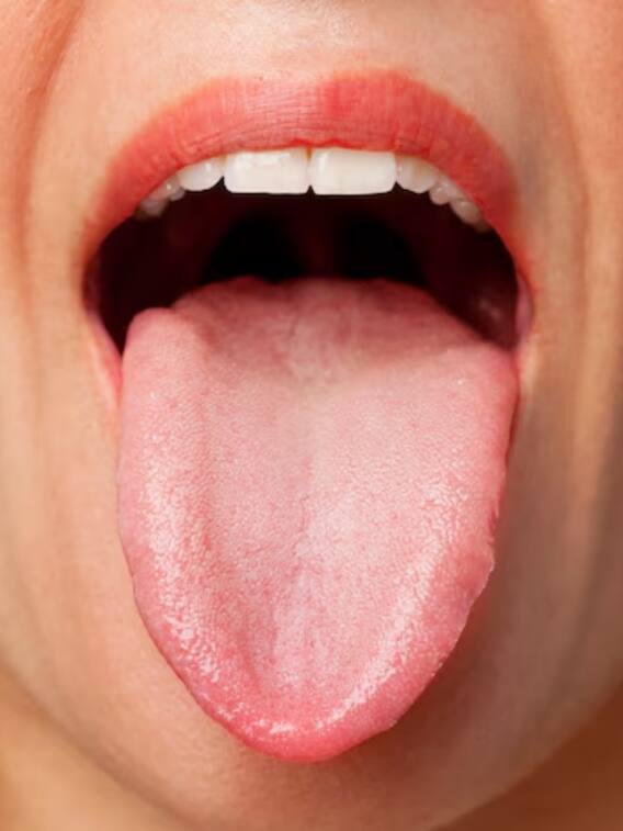 किस बीमारी में जीभ पर उगने लग जाते हैं बाल?