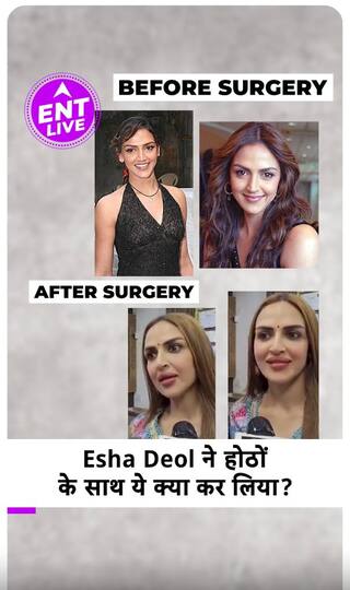 Esha Deol ने Lips देखकर Netizens ने किया React, क्या Actress ने कराई है Lip Job?