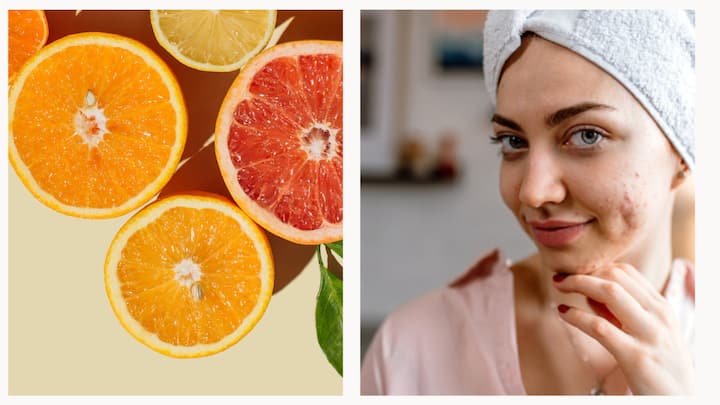 Malta, also called sweet oranges, is a fruit that not only tastes good but also has many health benefits. It can help with weight management and promote glowing skin.