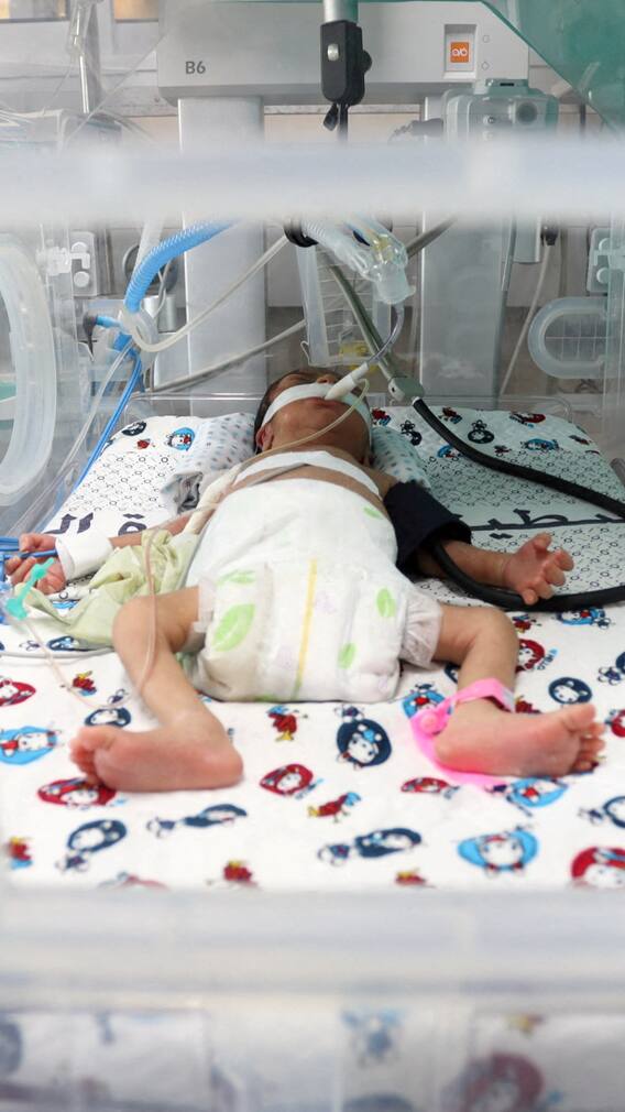 गाजा में मृतक गर्भवती के पेट से जिंदा निकला बच्चा