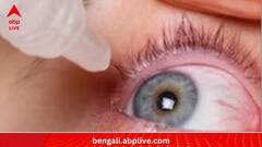 Lifestyle:জানেন কি, গ্লকোমায় দৃষ্টি খোয়ানো রুখতে চিকিৎসার পাশাপাশি জরুরি এগুলিও?