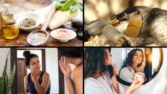 Sunburned Skin: How To Treat Your Skin After Sun Exposure? Know These Calming Solutions