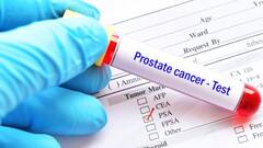 Cancer Blood Test: ਖੂਨ ਦੀ ਇੱਕ ਬੂੰਦ ਨਾਲ ਮਿੰਟਾਂ ਵਿੱਚ ਲੱਗ ਜਾਵੇਗਾ ਕੈਂਸਰ ਦਾ ਪਤਾ, ਖੋਜ 'ਚ ਖੁਲਾਸਾ