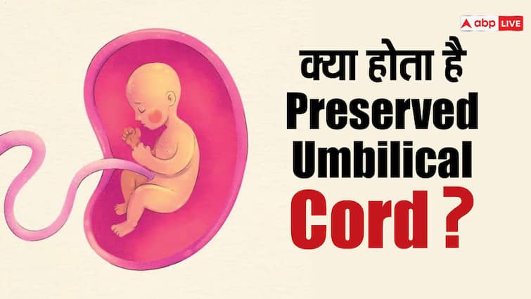 बच्चे की लाइफलाइन बन सकता है Preserved Umbilical Cord, इसकी मदद से सुलझा 14 साल पुराना मामला