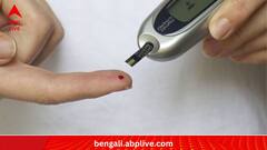 Lifestyle:রাতে ঘুম কম মানে বাড়তে পারে ডায়াবিটিসের আশঙ্কা, ইঙ্গিত নয়া গবেষণায়