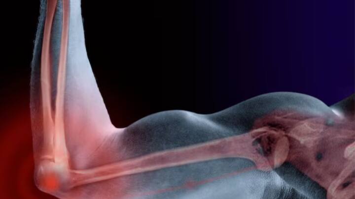 অপরদিকে, ড্রাগন ফলে উপস্থিত রয়েছে ম্যাগনেশিয়াম। যা মূলত খেলে হাড়ের স্বাস্থ্য ভাল করে।