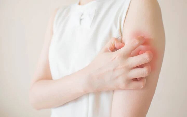 Health :શું આપને સતત ખંજવાળ આવે છે, તો અવગણશો નહિ, હોઇ શકે છે આ ઓર્ગન ડેમેજ Do you itch continuously, then do no't ignore it, it could be organ damage Health :શું આપને સતત ખંજવાળ આવે છે, તો અવગણશો નહિ, હોઇ શકે છે આ ઓર્ગન ડેમેજ