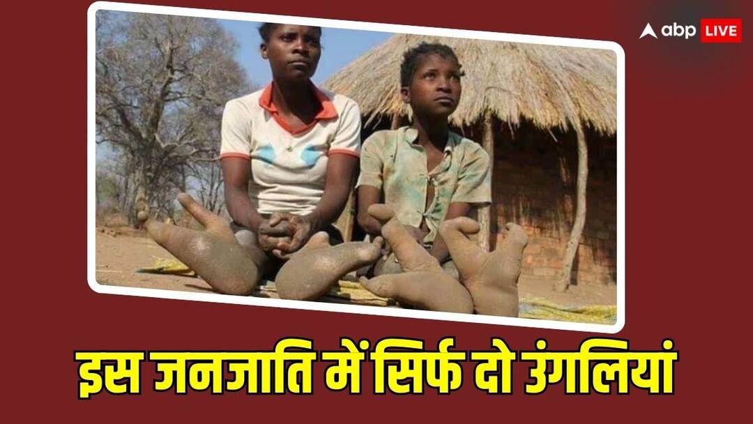 Vadoma Tribe: इस जनजाति के पैरों में सिर्फ 2 उंगलियां, दिखने में शुतुरमुर्ग जैसे हैं पैर This tribe has only 2 toes in their feet their feet look like those of an ostrich Vadoma Tribe: इस जनजाति के पैरों में सिर्फ 2 उंगलियां, दिखने में शुतुरमुर्ग जैसे हैं पैर