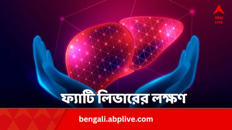 Fatty Liver Symptoms Hand And Leg Swelling Bengali News Fatty Liver: হাত-পা ফুলেছে আগের তুলনায়  ? ফ্যাটি লিভারের লক্ষণ নয় তো ?