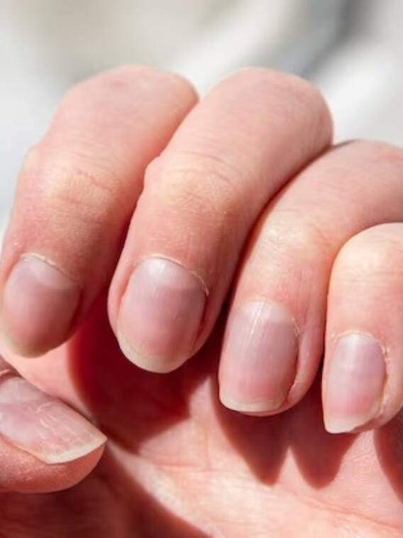 नाखून के निचले हिस्से में बने चांद का क्या मतलब है?