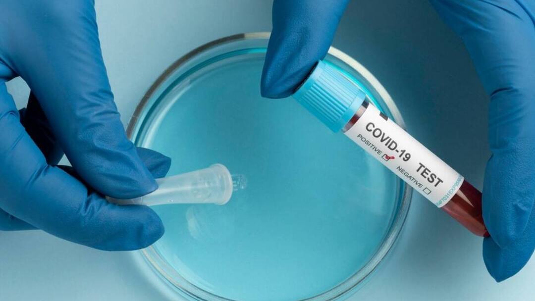 COVID19 vaccines covishield especially the AstraZeneca vaccine may cause VITT and blood clots called thrombosis with thrombocytopenia क्या वैक्सीन से हो रही है ब्लड क्लॉटिंग? जिससे हार्ट अटैक के साथ बढ़ेगा इन बीमारियों का खतरा