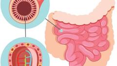 ઉનાળામાં પેટને ઠંડુ રાખવા માંગો છો તો આ ખાસ આયુર્વેદિક ટિપ્સ અપનાવો, એક અઠવાડિયામાં જ થશે ફાયદો