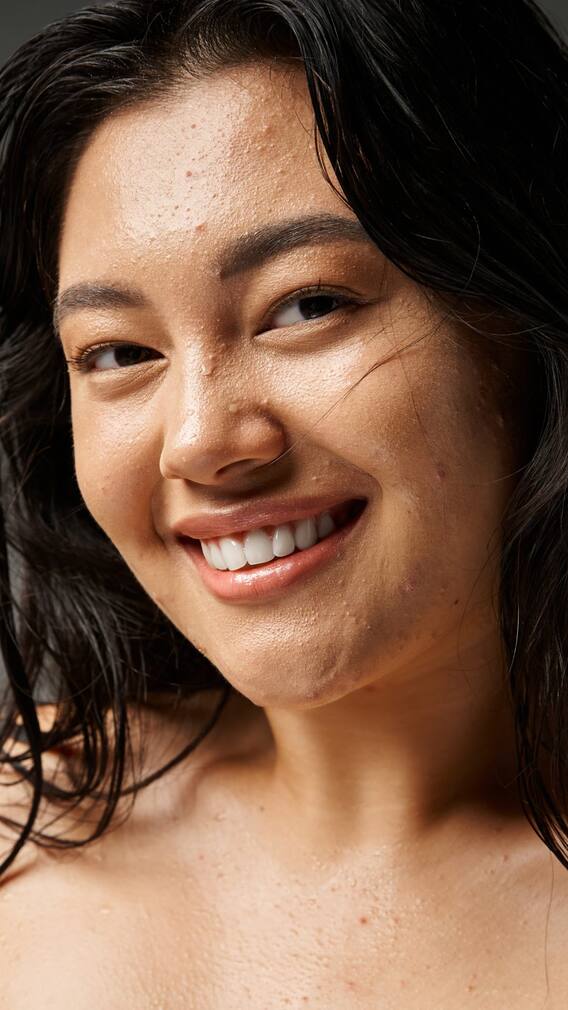 ఫేస్ ఫ్యాట్​ని తగ్గించుకోవడానికి ఈ టిప్స్ ఫాలో అవ్వాలి