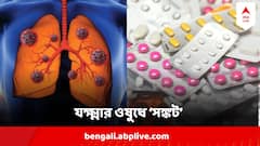 কেন্দ্রের ওষুধ যোগানে সমস্যা, সঙ্কট খোলা বাজারেও, যক্ষ্মা রোগীদের কী হবে? মাথায় হাত চিকিৎসকদের