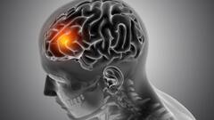 Brain Stroke: गर्मी में क्यों बढ़ रहे हैं ब्रेन स्ट्रोक के मामले? जानिए कारण और बचाव का तरीका...