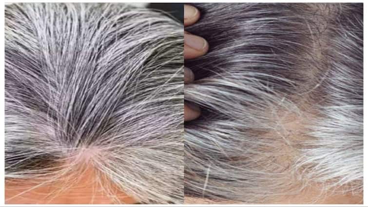 Grey Hair Tips How to how to get rid of white hair at young age naturally try this out Grey Hair: நரைமுடி பிரச்சினையா? அதுவும் இளமையிலே? உங்களுக்கான டிப்ஸ்