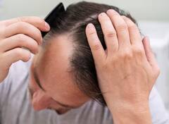 Hair Fall: ਜੇਕਰ ਤੁਸੀਂ ਵੀ ਝੜਦੇ ਵਾਲਾਂ ਤੋਂ ਹੋ ਪਰੇਸ਼ਾਨ, ਤਾਂ ਰੋਜ਼ ਖਾਣੀਆਂ ਸ਼ੁਰੂ ਕਰ ਦਿਓ ਆਹ ਚੀਜ਼ਾਂ