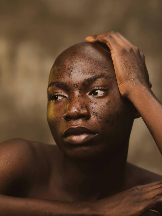 शादी से पहले गंजी क्यों हो जाती हैं यहां की लड़कियां