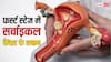 Cervical Cancer: फर्स्ट स्टेज में ही सर्वाइकल कैंसर की कर सकते हैं पहचान, बस कराना होगा ये टेस्ट