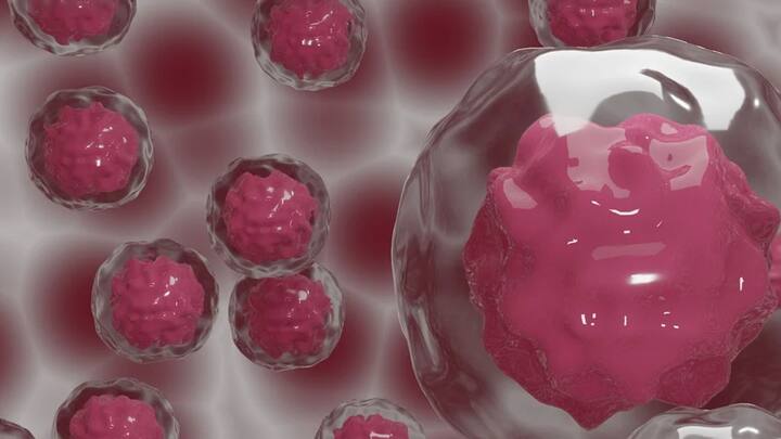 জনসংখ্যার নিরিখে বর্তমানে ক্যান্সার আক্রান্তের সংখ্যা লাগাতার বৃদ্ধি পেলেও, হাজার হাজার বছর আগেও পৃথিবীতে অস্তিত্ব ছিল ক্যান্সারের। কিন্তু মারণ রোগের নাম ক্যান্সার হল কী করে জানেন কি? পিক্সাবে