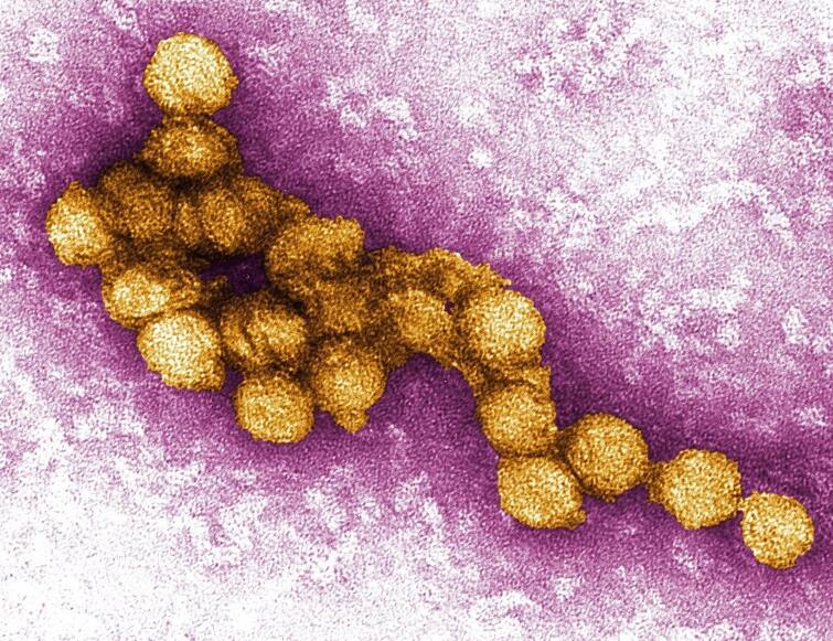 West Nile Virus: 10 cases of West Nile Virus in Kerala, know how dangerous WNV is; These are the symptoms કોરોના પછી વધુ એક વાયરસનો કહેર, કેરળમાં વેસ્ટ નાઇલ વાયરસના 10 કેસ, જાણો WNV કેટલું જોખમી છે; શું છે લક્ષણો