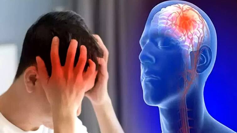 These common symptoms are experienced before brain stroke, do not ignore this complaint if it is accompanied by headache Health: બ્રેઇન સ્ટ્રોક પહેલા અનુભવાય છે આ સામાન્ય લક્ષણો,  માથાના દુખાવા સાથે રહે આ ફરિયાદ તો ન કરો  ઇગ્નોર