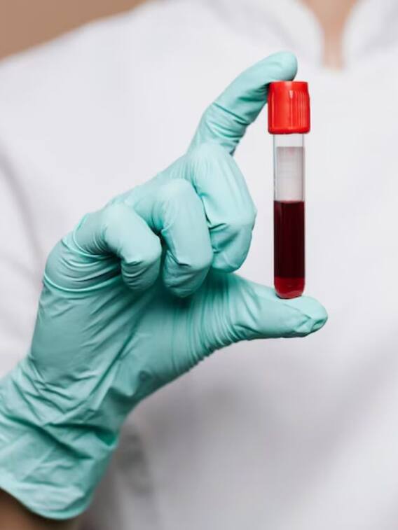 क्या होता है गोल्डन ब्लड ग्रुप?