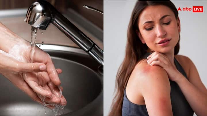 Trending News: ट्रूली बॉर्न डिफरेंट सीरीज से साझा किए गए एक अनुभव के बारे में एबी ने खुलकर बात की, जिसमें उन्होंने कहा कि उन्हें पानी से एलर्जी है. और वह अपना जीवन दर्द में बिता रही है.