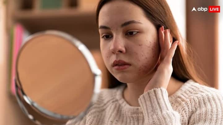 Pimples Problem: चेहरे को खूबसूरत बनाने के लिए कुछ लोग चावल के पानी का इस्तेमाल करते हैं. लेकिन क्या आप जानते हैं, इसका इस्तेमाल करना चेहरे के लिए फायदेमंद होता है या नहीं?